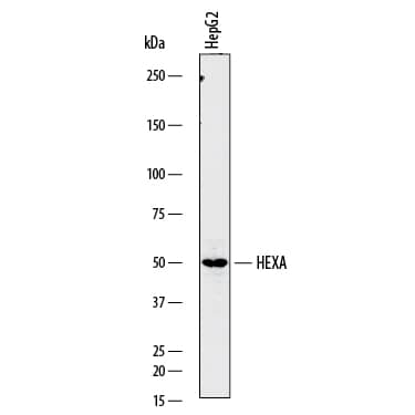 Western Blot Hexosaminidase A/HEXA Antibody [Unconjugated]