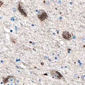 Hexosaminidase A/HEXA was detected in immersion fixed paraffin-embedded sections of human brain (hypothalamus) using Mouse Anti-Human Hexosaminidase A/HEXA Monoclonal Antibody (Catalog # MAB6237) at 15 µg/mL overnight at 4 °C. Before incubation with the primary antibody, tissue was subjected to heat-induced epitope retrieval using Antigen Retrieval Reagent-Basic (Catalog # CTS013). Tissue was stained using the Anti-Mouse HRP-DAB Cell & Tissue Staining Kit (brown; Catalog # CTS002) and counterstained with hematoxylin (blue). Specific staining was localized to the cytoplasm and lysosomes in neuronal cell bodies. View our protocol for Chromogenic IHC Staining of Paraffin-embedded Tissue Sections.