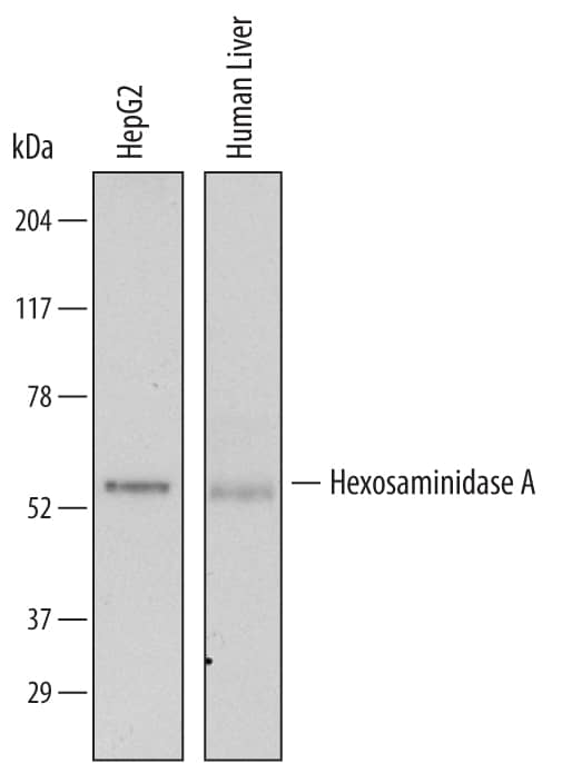 Western blot shows lysates of HepG2 human hepatocellular carcinoma cell line and human liver tissue. PVDF membrane was probed with 2 µg/mL of Mouse Anti-Human Hexosaminidase A/HEXA Monoclonal Antibody (Catalog # MAB6237) followed by HRP-conjugated Anti-Mouse IgG Secondary Antibody (Catalog # HAF007). A specific band was detected for Hexosaminidase A/HEXA at approximately 60 kDa (as indicated). This experiment was conducted under reducing conditions and using Immunoblot Buffer Group 1.