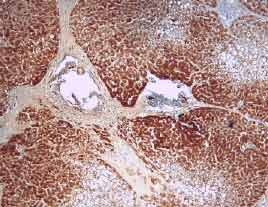 Immunohistochemistry HGF Antibody [Unconjugated]