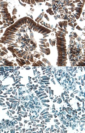 Immunohistochemistry HGF Activator Antibody [Unconjugated] - Pro form