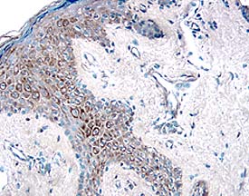 HGF R/c-MET was detected in immersion fixed paraffin-embedded sections of human skin using 15 µg/mL Goat Anti-Human HGF R/c-MET Antigen Affinity-purified Polyclonal Antibody (Catalog # AF276) overnight at 4 °C. Tissue was stained with the Anti-Goat HRP-DAB Cell & Tissue Staining Kit (brown; CTS008) and counterstained with hematoxylin (blue). View our protocol for Chromogenic IHC Staining of Paraffin-embedded Tissue Sections.