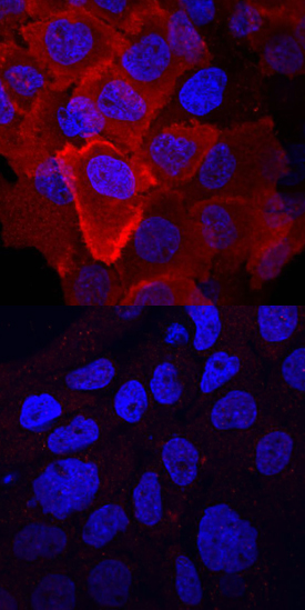 <b>Biological Strategies Validation. </b>HGF R/c-MET phosphorylated at Y1003 was detected in immersion fixed A431 human epithelial carcinoma cell line untreated (lower panel) or treated (upper panel) with pervanadate using Rabbit Anti-Human Phospho-HGF R/c-MET (Y1003) Antigen Affinity-purified Polyclonal Antibody (Catalog # AF4059) at 10 µg/mL for 3 hours at room temperature. Cells were stained using the NorthernLights™ 557-conjugated Anti-Rabbit IgG Secondary Antibody (red; Catalog # NL004) and counterstained with DAPI (blue). View our protocol for Fluorescent ICC Staining of Cells on Coverslips.