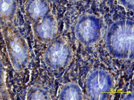 HGF R/c-MET was detected in immersion fixed paraffin-embedded sections of human colon array using Mouse Anti-Human HGF R/c-MET Monoclonal Antibody (Catalog # MAB3583) at 25 µg/mL overnight at 4 °C. Tissue was stained using the Anti-Mouse HRP-DAB Cell & Tissue Staining Kit (brown; Catalog # CTS002) and counterstained with hematoxylin (blue). View our protocol for Chromogenic IHC Staining of Paraffin-embedded Tissue Sections.