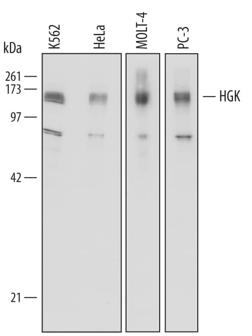 Western Blot HGK/MAP4K4 Antibody [Unconjugated]