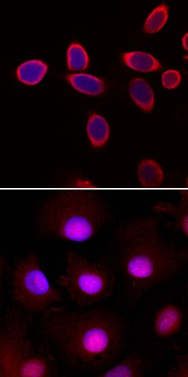 Immunocytochemistry HIC5/TGFB1I1 Antibody [Unconjugated]