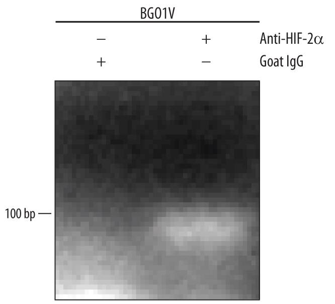 <b>Biological Strategies Validation. </b>BG01V human embryonic stem cells treated with 150 µM CoCl2 overnight were fixed using formaldehyde, resuspended in lysis buffer, and sonicated to shear chromatin. HIF-2a/EPAS1/DNA complexes were immunoprecipitated using 5 µg Goat Anti-Human/Rat HIF-2a/EPAS1 Antigen Affinity-purified Polyclonal Antibody (Catalog # AF2886) or control antibody (Catalog # AB-108-C) for 15 minutes in an ultrasonic bath, followed by Biotinylated Anti-Goat IgG Secondary Antibody (Catalog # BAF109). Immunocomplexes were captured using 50 µL of MagCellect Streptavidin Ferrofluid (Catalog # MAG999) and DNA was purified using chelating resin solution. Theoct-3/4promoter was detected by standard PCR.
