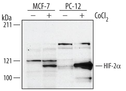 Western blot shows lysates of MCF-7 human breast cancer cell line and PC-12 rat adrenal pheochromocytoma cell line untreated (-) or treated (+) with 150 µM CoCl2for 16 h. PVDF membrane was probed with 1 µg/mL of Human/Rat HIF-2a/EPAS1 Polyclonal Antibody, followed by HRP-conjugated Anti-Goat IgG Secondary Antibody (Catalog # HAF109). A specific band was detected for HIF-2a/EPAS1 at approximately 115 kDa (as indicated). This experiment was conducted under reducing conditions and using Immunoblot Buffer Group 1.