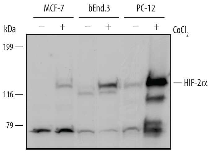 <b>Biological Strategies Validation. </b>Western blot shows lysates of MCF-7 human breast cancer cell line, bEnd.3 mouse endothelioma cell line, and PC-12 rat adrenal pheochromocytoma cell line untreated (-) or treated (+) with 150 µM CoCl2for 16 hours. PVDF Membrane was probed with 1 µg/mL of Goat Anti-Mouse HIF-2a/EPAS1 Antigen Affinity-purified Polyclonal Antibody (Catalog # AF2997) followed by HRP-conjugated Anti-Goat IgG Secondary Antibody (Catalog # HAF109). A specific band was detected for HIF-2a/EPAS1 at approximately 120 kDa (as indicated). This experiment was conducted under reducing conditions and using Immunoblot Buffer Group 1.