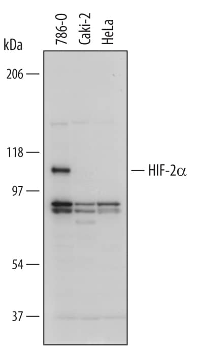 Western blot shows lysates of 786-O human renal cell adenocarcinoma cell line (HIF-2a positive), Caki-2 human clear cell carcinoma epithelial cell line (HIF-2a negative), and HeLa human cervical epithelial carcinoma cell line (HIF-2a negative). PVDF Membrane was probed with 1 µg/mL of Human HIF-2a/EPAS1 Monoclonal Antibody (Catalog # MAB2886) followed by HRP-conjugated Anti-Mouse IgG Secondary Antibody (Catalog # HAF007). A specific band was detected for HIF-2a/EPAS1 at approximately 110 kDa (as indicated). This experiment was conducted under reducing conditions and using Immunoblot Buffer Group 1.