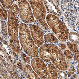 <b>Biological Strategies Validation. </b>HIF-1 alpha/HIF1A was detected in immersion fixed paraffin-embedded sections of human kidney using Mouse Anti-Human/Mouse/Rat HIF-1 alpha/HIF1A Monoclonal Antibody (Catalog # MAB1536) at 5 µg/mL for 1 hour at room temperature followed by incubation with the Anti-Mouse IgG VisUCyte™ HRP Polymer Antibody (Catalog # VC001). Before incubation with the primary antibody, tissue was subjected to heat-induced epitope retrieval using Antigen Retrieval Reagent-Basic (Catalog # CTS013). Tissue was stained using DAB (brown) and counterstained with hematoxylin (blue). Specific staining was localized to cytoplasm and nuclei. View our protocol for IHC Staining with VisUCyte HRP Polymer Detection Reagents.