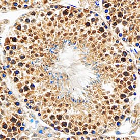 HIF-2a/EPAS1 was detected in perfusion fixed frozen sections of mouse testis using Goat Anti-Human/Mouse/Rat HIF-2a/EPAS1 Antigen Affinity-purified Polyclonal Antibody (Catalog # AF2997) at 1.7 µg/mL overnight at 4 °C. Tissue was stained using the Anti-Goat HRP-DAB Cell & Tissue Staining Kit (brown; Catalog # CTS008) and counterstained with hematoxylin (blue). Specific staining was localized to cytoplasm and nuclei in spermatocytes. View our protocol for Chromogenic IHC Staining of Frozen Tissue Sections.