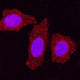 Immunocytochemistry HIPK2 Antibody (493918) [Unconjugated]