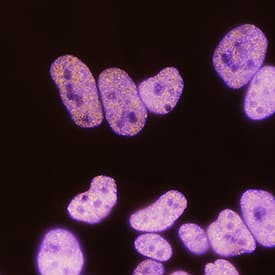 <b>Biological Strategies Validation. </b>HIST3H3 was detected in immersion fixed HeLa human cervical epithelial carcinoma cell line using Rabbit Anti-Human HIST3H3 Monoclonal Antibody (Catalog # MAB9448) at 0.3 µg/mL for 3 hours at room temperature. Cells were stained using the NorthernLights™ 557-conjugated Anti-Rabbit IgG Secondary Antibody (yellow; Catalog # NL004) and counterstained with DAPI (blue). Specific staining was localized to cell nuclei. View our protocol for Fluorescent ICC Staining of Cells on Coverslips.