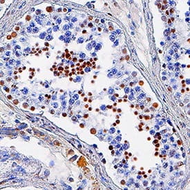 HIST3H3 was detected in immersion fixed paraffin-embedded sections of human testis using Rabbit Anti-Human HIST3H3 Monoclonal Antibody (Catalog # MAB9448) at 3 µg/mL for 1 hour at room temperature followed by incubation with the Anti-Rabbit IgG VisUCyte™ HRP Polymer Antibody (Catalog # VC003). Tissue was stained using DAB (brown) and counterstained with hematoxylin (blue). Specific staining was localized to cell nuclei. View our protocol for IHC Staining with VisUCyte HRP Polymer Detection Reagents.