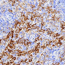 HM74A/PUMA-G/GPR109A was detected in immersion fixed paraffin-embedded sections of human spleen tissue using Rat Anti-Human HM74A/PUMA-G/GPR109A Monoclonal Antibody (Catalog # MAB27601) at 5 µg/mL for 1 hour at room temperature followed by incubation with the Anti-Rat IgG VisUCyte™ HRP Polymer Antibody (Catalog # VC005). Before incubation with the primary antibody, tissue was subjected to heat-induced epitope retrieval using Antigen Retrieval Reagent-Basic (Catalog # CTS013). Tissue was stained using DAB (brown) and counterstained with hematoxylin (blue). Specific staining was localized to cell surface. View our protocol for IHC Staining with VisUCyte HRP Polymer Detection Reagents.