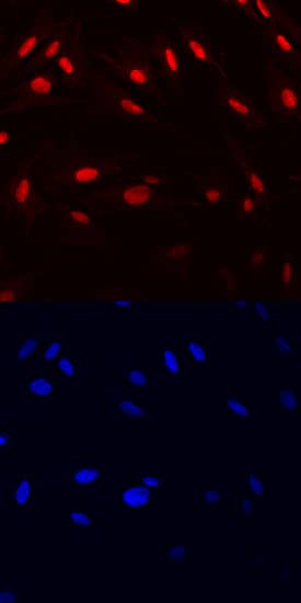 Immunocytochemistry HMGB1/HMG-1 Antibody (115603) [Unconjugated]