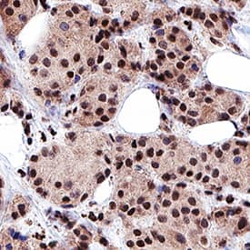 Immunohistochemistry HMGB1/HMG-1 Antibody (115603) [Unconjugated]