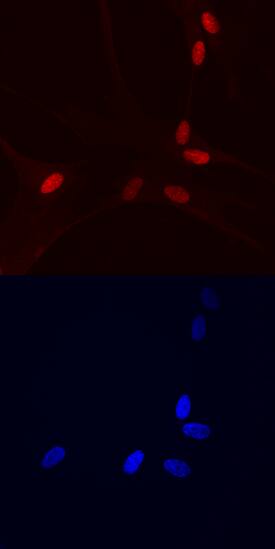 HMGB3 was detected in immersion fixed Detroit 551 human skin fibroblast cell line using Human/Mouse HMGB3 Monoclonal Antibody (Catalog # MAB55071) at 10 µg/mL for 3 hours at room temperature. Cells were stained using the NorthernLights™ 557-conjugated Anti-Mouse IgG Secondary Antibody (red, upper panel; Catalog # NL007) and counterstained with DAPI (blue, lower panel). Specific staining was localized to nuclei. View our protocol for Fluorescent ICC Staining of Cells on Coverslips.