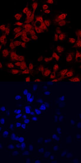 Immunocytochemistry HNF-6/ONECUT1 Antibody [Unconjugated]