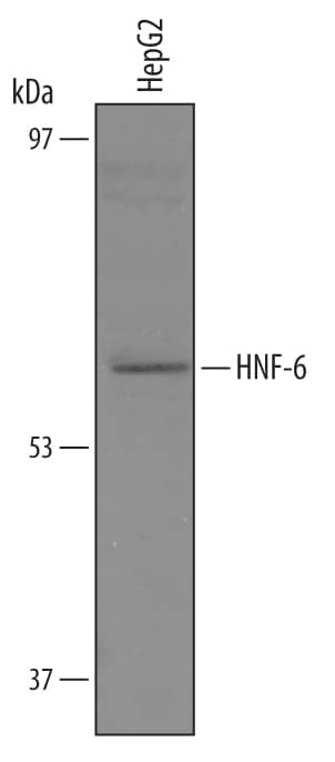 Western Blot HNF-6/ONECUT1 Antibody [Unconjugated]