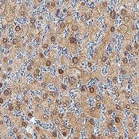HNF-3 beta /FoxA2 was detected in immersion fixed paraffin-embedded sections of human liver using Goat Anti-Human HNF-3 beta /FoxA2 Antigen Affinity-purified Polyclonal Antibody (Catalog # AF2400) at 3 µg/mL for 1 hour at room temperature followed by incubation with the Anti-Goat IgG VisUCyte™ HRP Polymer Antibody (VC004). Before incubation with the primary antibody, tissue was subjected to heat-induced epitope retrieval using Antigen Retrieval Reagent-Basic (CTS013). Tissue was stained using DAB (brown) and counterstained with hematoxylin (blue). Specific staining was localized to cytoplasm and nuclei. View our protocol for IHC Staining with VisUCyte HRP Polymer Detection Reagents.