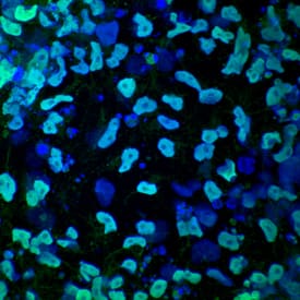 BG01V human embryonic stem cells were differentiated into mesendoderm using the StemXVivo Endoderm Kit (SC019). HNF-3 beta /FoxA2 was detected in immersion fixed mesendoderm differentiated BG01V human embryonic stem cells using 10 µg/mL Goat Anti-Human HNF-3 beta /FoxA2 Alexa Fluor® 488-conjugated Antigen Affinity-purified Polyclonal Antibody (Catalog # IC2400G, green) for 3 hours at room temperature and counterstained with DAPI (blue). View our protocol for Fluorescent ICC Staining of Cells on Coverslips.
