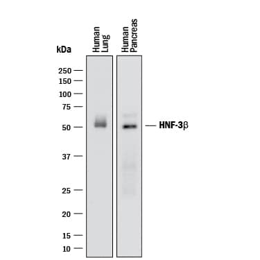 Western blot shows lysates of human lung tissue and human pancreas tissue. PVDF membrane was probed with 2 µg/mL of Rabbit Anti-Human/Mouse/Rat HNF-3 beta /FoxA2 Monoclonal Antibody (Catalog # MAB2400) followed by HRP-conjugated Anti-Rabbit IgG Secondary Antibody (Catalog # HAF008). A specific band was detected for HNF-3 beta /FoxA2 at approximately 50 kDa (as indicated). This experiment was conducted under reducing conditions and using Immunoblot Buffer Group 1.
