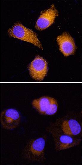 Immunocytochemistry HOIP/RNF31 Antibody (875227) [Unconjugated]