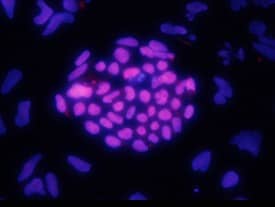 Immunocytochemistry HOXA1 Antibody