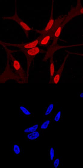Immunocytochemistry HOXB13 Antibody [Unconjugated]