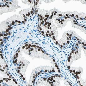 Immunohistochemistry HOXB13 Antibody [Unconjugated]