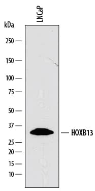 Western Blot HOXB13 Antibody [Unconjugated]