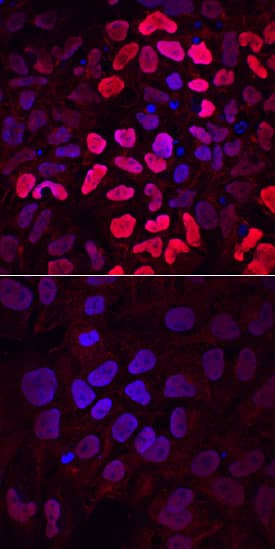Immunocytochemistry HOXB1 Antibody