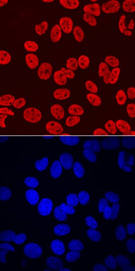 HOXB7 was detected in immersion fixed MCF-7 human breast cancer cell line using Mouse Anti-Human HOXB7 Monoclonal Antibody (Catalog # MAB8040) at 10 µg/mL for 3 hours at room temperature. Cells were stained using the NorthernLights™ 557-conjugated Anti-Mouse IgG Secondary Antibody (red, upper panel; Catalog # NL007) and counterstained with DAPI (blue, lower panel). Specific staining was localized to nuclei. View our protocol for Fluorescent ICC Staining of Cells on Coverslips.