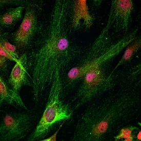 HOXD10 was detected in immersion fixed human induced pluripotent stem (iPS) cells differentiated to neural progenitor cells (NPC) using Goat Anti-Human HOXD10 Antigen Affinity-purified Polyclonal Antibody (Catalog # AF10413) at 10 µg/mL, and co-stained with Mouse Anti-Human Nestin Monoclonal Antibody (Catalog # MAB1259) at 10 µg/mL, for 3 hours at room temperature. Cells were stained using the NorthernLights™ 557-conjugated Anti-Goat IgG Secondary Antibody (red; Catalog # NL001), NorthernLights™ 493-conjugated Anti-Mouse IgG Secondary Antibody (green; Catalog # NL009) and counterstained with DAPI (blue). Specific staining for HOXD10 was localized to nucleus, while Nestin co-staining was cytoplasmic. View our protocol for Fluorescent ICC Staining of Cells on Coverslips.