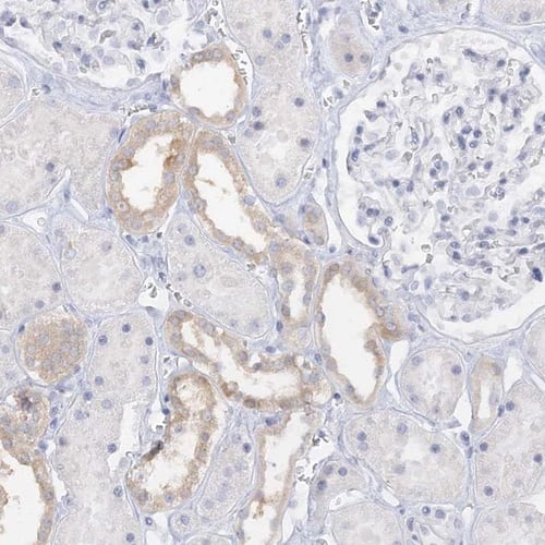 Immunohistochemistry-Paraffin TRIM2 Antibody - BSA Free