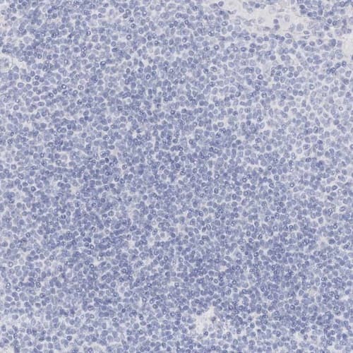 Immunohistochemistry-Paraffin TRIM2 Antibody - BSA Free