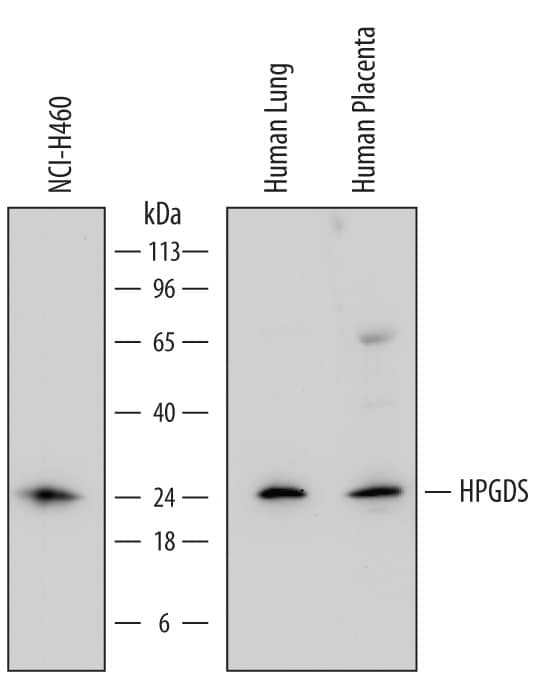 Western Blot Hematopoietic Prostaglandin D Synthase/HPGDS Antibody (735301) [Unconjugated]