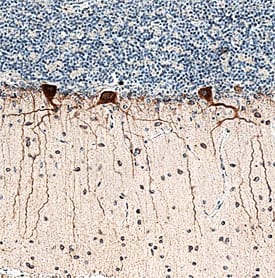 Immunohistochemistry Heparan Sulfate 3-O-Sulfotransferase 4/HS3ST4 Antibody (712010)
