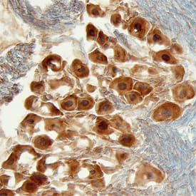 Immunohistochemistry Heparan Sulfate 6-O-Sulfotransferase 3/HS6ST3 Antibody