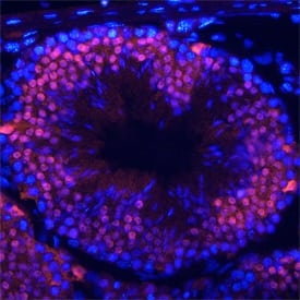 HSF1 was detected in perfusion fixed frozen sections of mouse testis using Rat Anti-Mouse HSF1 Monoclonal Antibody (Catalog # MAB7130) at 25 µg/mL overnight at 4 °C. Tissue was stained using the NorthernLights™ 557-conjugated Anti-Rat IgG Secondary Antibody (red; Catalog # NL013) and counterstained with DAPI (blue). Specific staining was localized to nuclei of spermatocytes. View our protocol for Fluorescent IHC Staining of Frozen Tissue Sections.
