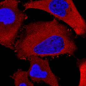 HSP27 was detected in immersion fixed HeLa human cervical epithelial carcinoma cell line using Rat Anti-Human HSP27 Monoclonal Antibody (Catalog # MAB15801) at 8 µg/mL for 3 hours at room temperature. Cells were stained using the NorthernLights™ 557-conjugated Anti-Rat IgG Secondary Antibody (red; Catalog # <a class=