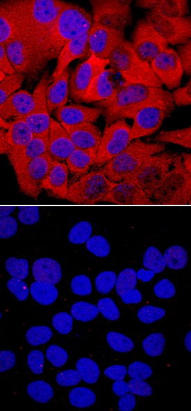 <b>Biological Strategies Validation. </b>HSP27 phosphorylated at S78/S82 was detected in immersion fixed HeLa human cervical epithelial carcinoma cell line unstimulated (lower panel) or stimulated with 20 mJ/cm2ultraviolet radiation (upper panel) using Rabbit Anti-Human Phospho-HSP27 (S78/S82) Monoclonal Antibody (Catalog # MAB23141) at a 10 µg/mL for 3 hours at room temperature. Cells were stained using the NorthernLights™ 557-conjugated Anti-Rabbit IgG Secondary Antibody (red; Catalog # NL004) and counterstained with DAPI (blue). Specific staining was localized to cytoplasm and nuclei. View our protocol for Fluorescent ICC Staining of Cells on Coverslips.