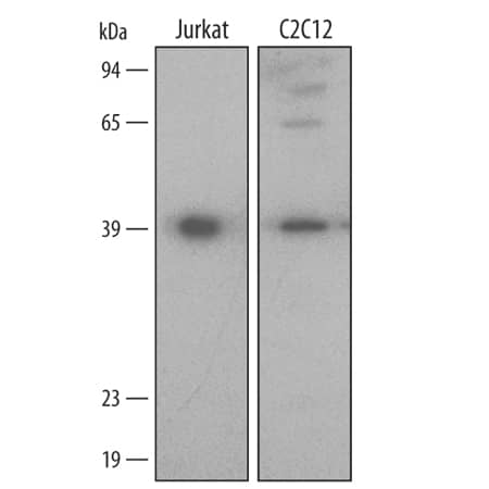 Western blot shows lysates of Jurkat human acute T cell leukemia cell line and C2C12 mouse myoblast cell line. PVDF membrane was probed with 1 µg/mL of Human/Mouse HSP40/DNAJB1 Antigen Affinity-purified Polyclonal Antibody (Catalog # AF4145) followed by HRP-conjugated Anti-Sheep IgG Secondary Antibody (Catalog # HAF016). A specific band was detected for HSP40/DNAJB1 at approximately 40 kDa (as indicated). This experiment was conducted under reducing conditions and using Immunoblot Buffer Group 2.