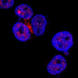HSP70/HSPA1A was detected in immersion fixed Jurkat human acute T cell leukemia cell line using Mouse Anti-Human/Mouse/Rat HSP70/HSPA1A Monoclonal Antibody (Catalog # MAB16631) at 8 µg/mL for 3 hours at room temperature. Cells were stained using the NorthernLights™ 557-conjugated Anti-Mouse IgG Secondary Antibody (red; Catalog # NL007) and counterstained with DAPI (blue). Specific staining was localized to nuclei. View our protocol for Fluorescent ICC Staining of Non-adherent Cells.