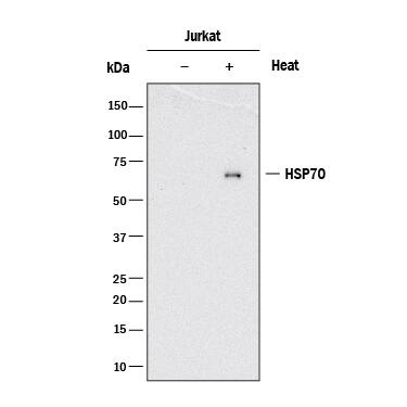Western blot shows lysates of Jurkat human acute T cell leukemia cell line untreated (-) or treated (+) with 42° C heat shock for 30 minutes and allowed to recover for 3 hours. PVDF membrane was probed with 2 µg/mL of Mouse Anti-Human/Mouse/Rat HSP70/HSPA1A Monoclonal Antibody (Catalog # MAB16631) followed by HRP-conjugated Anti-Mouse IgG Secondary Antibody (Catalog # HAF018). A specific band was detected for HSP70/HSPA1A at approximately 70 kDa (as indicated). This experiment was conducted under reducing conditions and using Immunoblot Buffer Group 1.