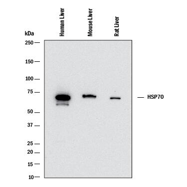 <b>Biological Strategies Validation. </b>Western blot shows lysates of human liver tissue, mouse liver tissue, and rat liver tissue. PVDF membrane was probed with 2 µg/mL of Mouse Anti-Human/Mouse/Rat HSP70/HSPA1A Monoclonal Antibody (Catalog # MAB16631) followed by HRP-conjugated Anti-Mouse IgG Secondary Antibody (Catalog # HAF018). A specific band was detected for HSP70/HSPA1A at approximately 70 kDa (as indicated). This experiment was conducted under reducing conditions and using Immunoblot Buffer Group 1.