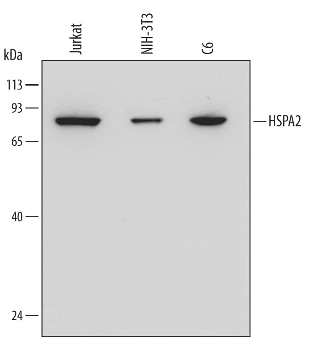 Western blot shows lysates of Jurkat human acute T cell leukemia cell line, NIH-3T3 mouse embryonic fibroblast cell line, and C6 rat glioma cell line. PVDF Membrane was probed with 1 µg/mL of Mouse Anti-Human/Mouse/Rat HSPA2 Monoclonal Antibody (Catalog # MAB6010) followed by HRP-conjugated Anti-Mouse IgG Secondary Antibody (Catalog # HAF007). A specific band was detected for HSPA2 at approximately 70 kDa (as indicated). This experiment was conducted under reducing conditions and using Immunoblot Buffer Group 2.