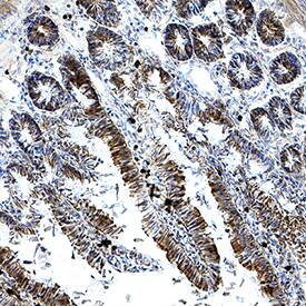 HSPA8/HSC71 was detected in immersion fixed frozen sections of rat intestine using Goat Anti-Human/Mouse/Rat HSPA8/HSC71 Antigen Affinity-purified Polyclonal Antibody (Catalog # AF4148) at 3 µg/mL for 1 hour at room temperature followed by incubation with the Anti-Goat IgG VisUCyte™ HRP Polymer Antibody (Catalog # VC004). Tissue was stained using DAB (brown) and counterstained with hematoxylin (blue). Specific staining was localized to epithelial cells in intestinal glands. View our protocol for IHC Staining with VisUCyte HRP Polymer Detection Reagents.